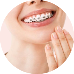 مستلزمات تقويم الاسنان 