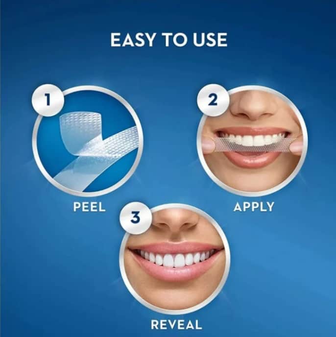 CREST لصقات تبييض الأسنان الترا وايت من كرست 28 لصقة x 14 استخدام