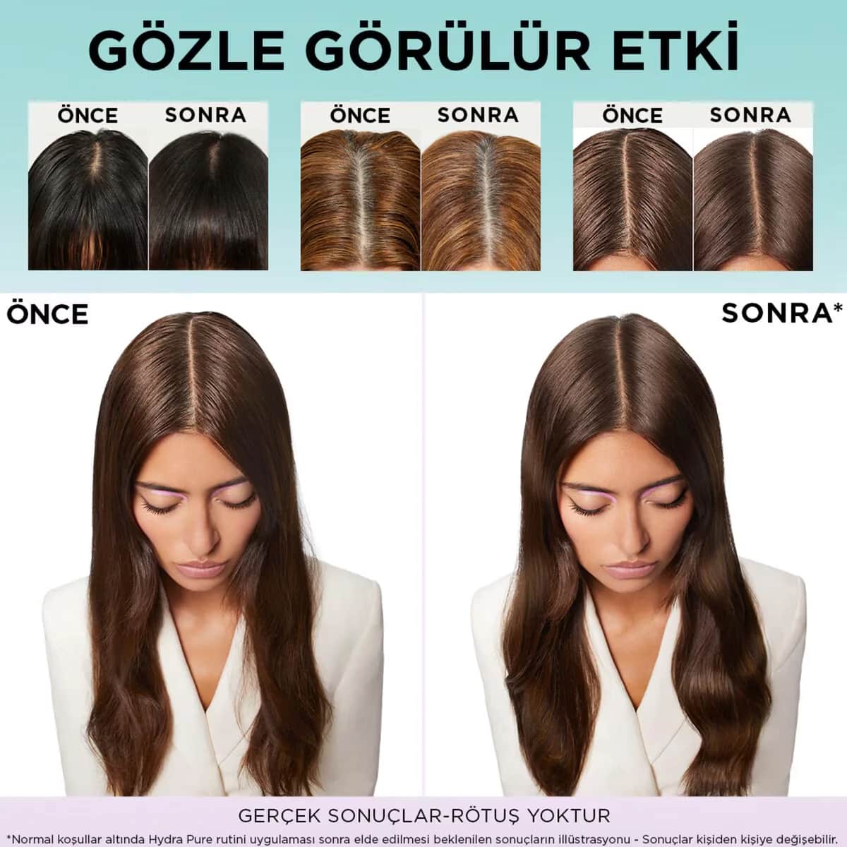 L'Oreal Paris شامبو إلسيف هيدرا هيالورونيك بيور المضاد للزيوت والمنقي مع حمض الساليسيليك من لوريال باريس، 300 مل