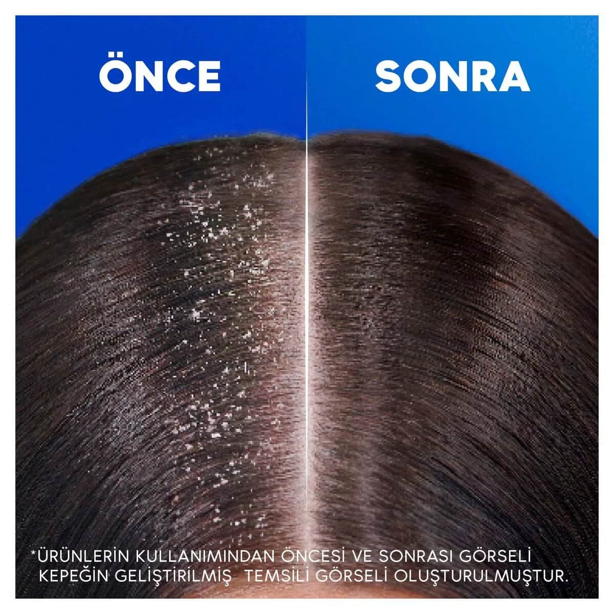 Head & Shoulders شامبو هيد آند شولدرز للعناية الكلاسيكية 250 مل