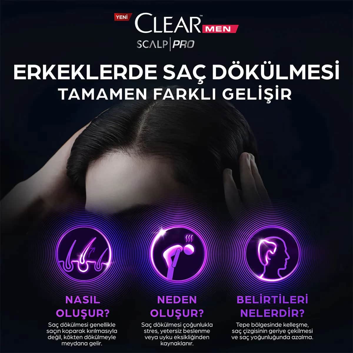 Clear شامبو كلير مين المضاد للتساقط والمقوي 300 مل