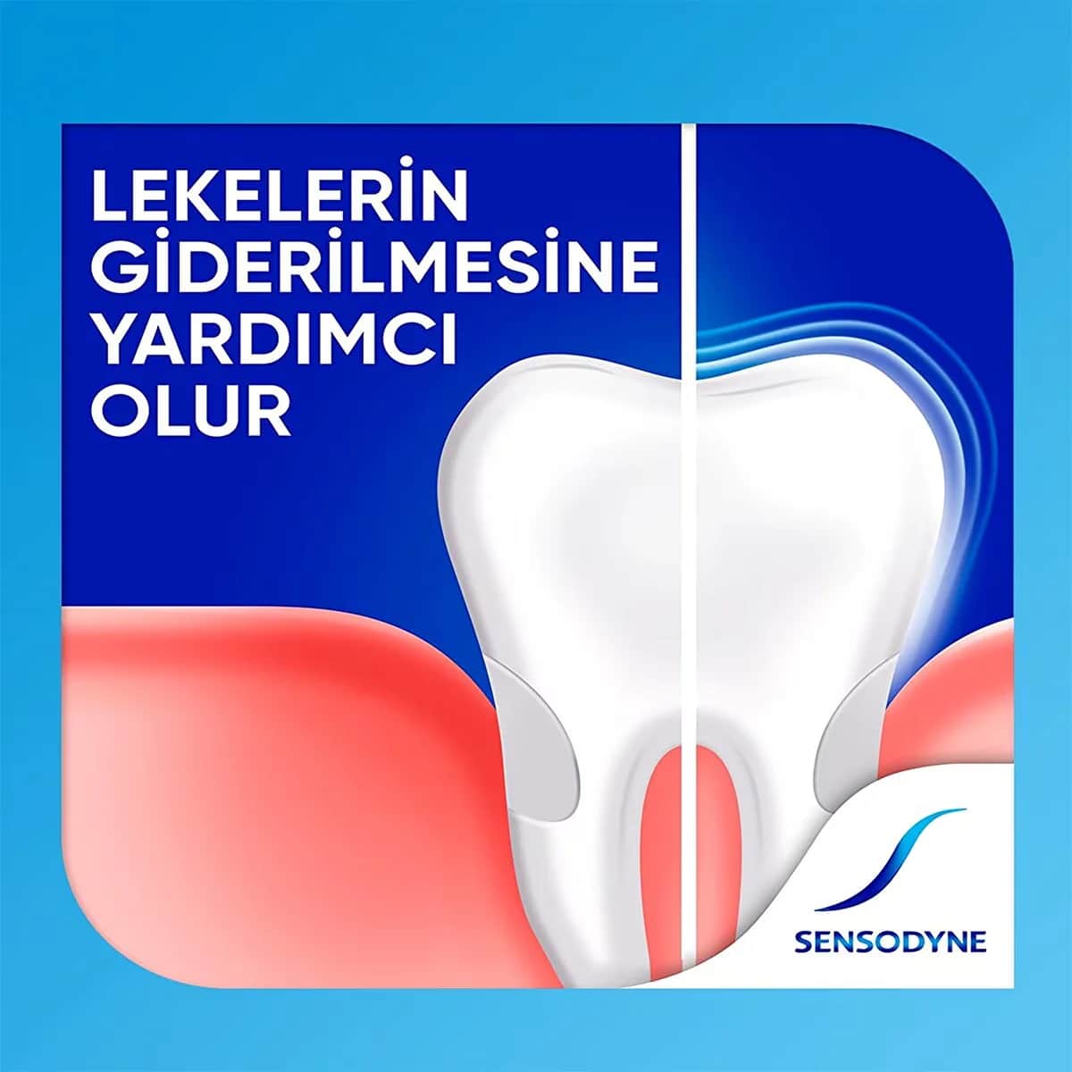 Sensodyne معجون أسنان سنسوداين إف بالفلورايد 100 مل