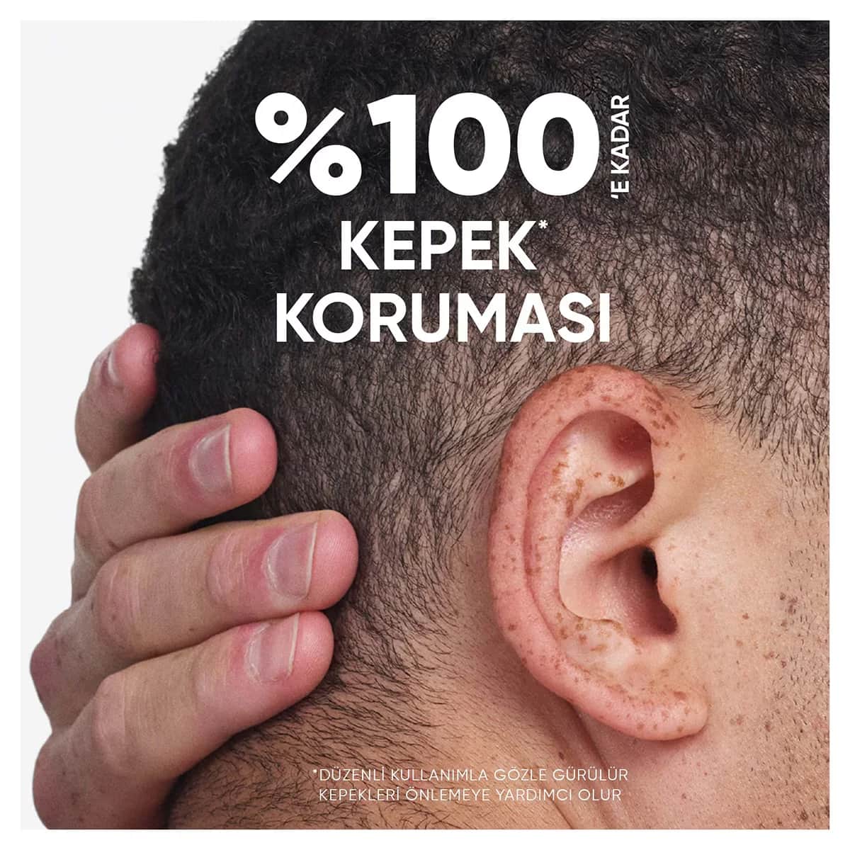 Head & Shoulders شامبو هيد آند شولدرز بالليمون ٢ في ١ ٣٠٠ مل